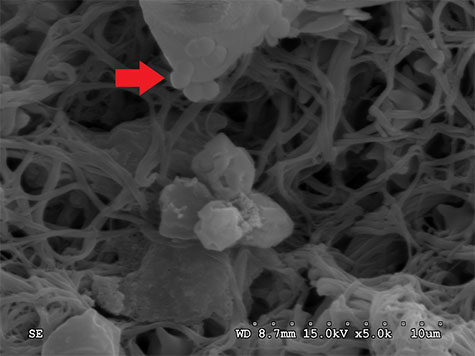An electron micrograph of Mannheimia haemolytica in a bovine lung.