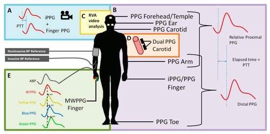 A visualization of the methods multi-site photoplethysmography (PPG) to measure the pulse transit time (PTT).