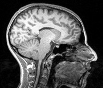 Brain Magnetic Resonance Imaging